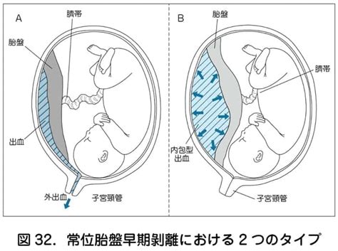 胎盤形成時期|胎盤ってどんな役割？完成する時期や赤ちゃんへの影。